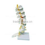 Life-size 5 Pcs Anatomical Lumbar Vertebra Model thumbnail-2