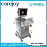 Carejoy 10 Inch Trolley Ultrasound Scanner Machine RUS-9000D With Convex Probe thumbnail-1