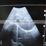 CE Approved Portable Ultrasound Scanner With 3.5Mhz Multi-frequency Convex Probe RUS-9000E thumbnail-4