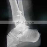 CE KND-A/F Medical Thermal x Ray Film China thumbnail-5