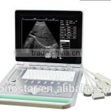 C5 laptop Multi language Multi language color doppler ultrasound scanner