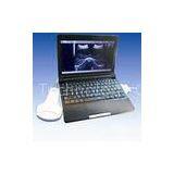 Ultrasound scanner laptop movable light easy to carry