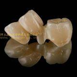 Dental Crown Zirconia Cercon,dental Teeth,dental Prosthesis Laboratoire Dentaire, Dentallabor, Laboratorio Dental, Dental Laboratory, Shenzhen LJ Dental Lab thumbnail-4