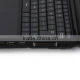 Portable Laptop Ultrasound Scanner With CE thumbnail-5