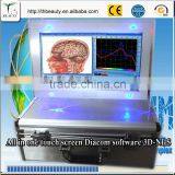 2015 Protable Computer Style All in One Rapid Diagnostic Test Device Detector Tester thumbnail-4