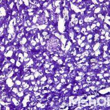 Inverted Biological Microscope With Phase Contrast MI52-N thumbnail-3