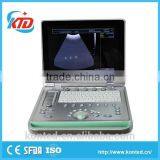 Hot Sale Full Digital Technology Ultrasound Scanner/ Echographe With Ce And Iso thumbnail-1