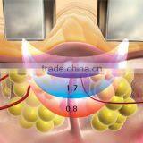 Viora Reaction for Sale thumbnail-2