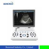 Portable Color Doppler Ultrasound Scanner Bene-3s