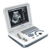 Ноутбук-тип черно-белый ультразвуковой сканер диагностического оборудования thumbnail-2