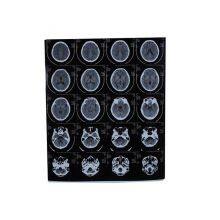 Digital X-ray Films，Dry Films, Thermal Films for Digital X-ray thumbnail-5