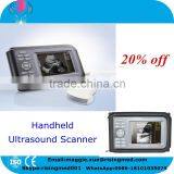 Promotion Palm Ultrasound Scanner HandScan H8 With 3.5 Mhz Convex Probe 5.5 Inch Monitor thumbnail-1