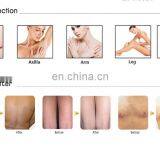 New Year Promotion Niansheng Factory Commercial 808nm 810 Diode Laser Hair Removal Machine Price thumbnail-5