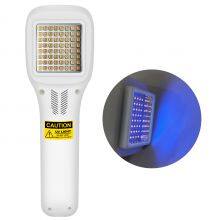 High Effective Solution 308nm Excimer Uvb Laser Vitiligo Treatment Device for Psoriasis and Vitiligo thumbnail-3