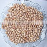 2013 light speckled kidney beans