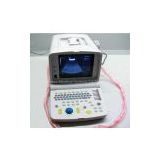 Portable Ultrasound Scanner----CE Approved Ultrasound Machine