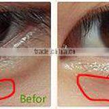 Weight Loss Best Effective Machines Cavitation Figure Shaping Body Slimming Skin Tightening Fat Melting Slimming Machine Ultrasonic Cavitation Cavi Lipo Machine thumbnail-5