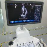 Trolly 2D Echocardiography Color Doppler Ultrasound Scanner thumbnail-3
