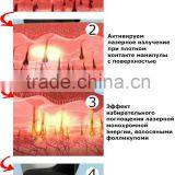 Diode Laser Skin Rejuvenation Equipment 808nm Diode Laser (808) thumbnail-5