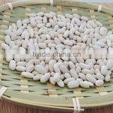 China Spanish White Kidney Beans thumbnail-2