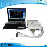 LTUB10 CE Medical Portable Ultrasound Equipment China