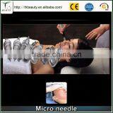 Electric Micro-nanometer Needle Microneedles Needles Microneedles Micro Nano Silicon Wafer Needle thumbnail-2
