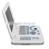 Hot Cheapest Abdominal Pregnant Diagnosis Laptop Ultrasound Scanner/Machine With Probe/Transducer-RUS-9000F2 thumbnail-3