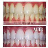 Teeth Whitening Tooth Whitener Gel Pen thumbnail-3