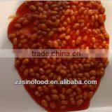 All Types of Canned White Kidney Beans Canned Food thumbnail-1