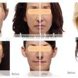 Vagina Tightening 2015 Advanced Vaginal Tightening Fractional Co2 Laser Bison Fractional Rf Beauty Machine Tattoo /lip Line Removal thumbnail-2