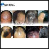 LCL2 Laser Hair Restoration Kit & Massage Loss Growth Comb Brush thumbnail-1