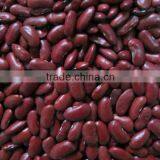 Quality Kidney Beans,Red and Black Kidney Beans,white Kidney Beans thumbnail-2
