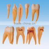 Enlarged Model of Teeth thumbnail-1