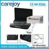 Carejoy CE Laptop 10.1 Inch Ultrasound Scanner / Machine With 3.5Mhz Convex Probe Good Price thumbnail-1