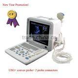 Best-selling CE Approved USB Portable Ultrasound Scanner With 3.5Mhz Multi-frequency Convex Probe RUS-9000B thumbnail-1