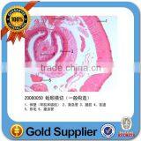 Oral Pathology Teaching Slides