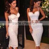 Hot 2015 Newest White Lace 2 Piece Set Knee Length Sexy Lady HL Bandage Dress Night Wear Celebrity Slim Dress thumbnail-1