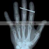 Medical Manufacturer Made in China Supplier for Hospital Dry Film Japan Film thumbnail-4