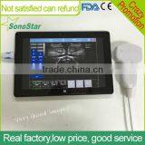 Sonostar cheapest portable ultrasound machine black and white ultrasound machine UPad-10