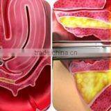 FDA Approved YUWEI Newest Arrival!!! Fractional Laser + CO2 Vagina Tightening Surgery + Vaginal Rejuvenation Medically Cosmetic Machine thumbnail-6