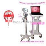 Digital High-Pixel Electronic Colposcope(RCS-500ii) With 1,000,000 Pixels thumbnail-1