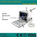 CE Approved Laptop/Portable Ultrasound Scanner With 3.5Mhz Multi-frequency Convex Probe RUS-9000B thumbnail-1