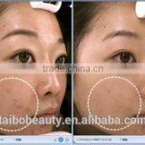 Professional Diamond Water Dermabrasion Face Cleaning Machines thumbnail-6