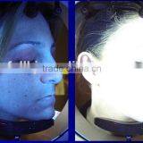 Magic Mirror 3D Skin Analyzer/ Best RGB+PL+UV Skin Analyzer thumbnail-4