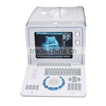 2016 Cheap Price Portable Full Digital Ultrasound Scanner/Machine With Probe/Transducers-RUS-6000D