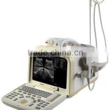 B-Ultrasound Portable Ultrasound Scanner