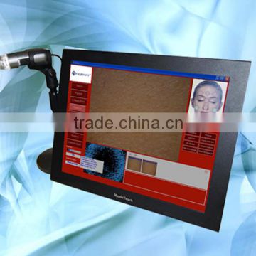 2014 newest design portable skin scope analysis