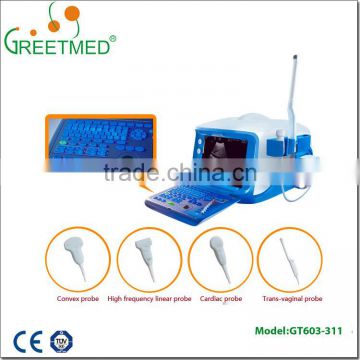 High quality new design cheap ultrasound machine