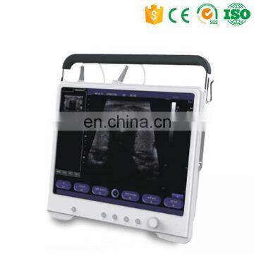 MY-A012 Portable ultrasound & ultrasound machine portable & ultrasound diagnostic equipment