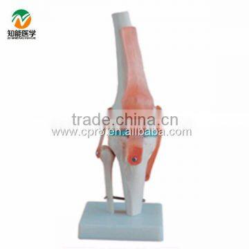 BIX-A1019 Vivid Life-size Artificial Knee Joint Model